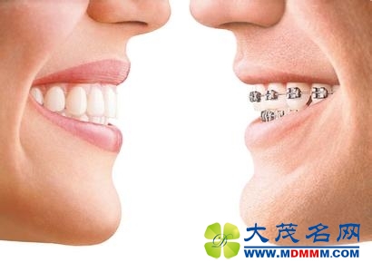 u=4095884074,3533796235&amp;fm=11&amp;gp=0.jpg