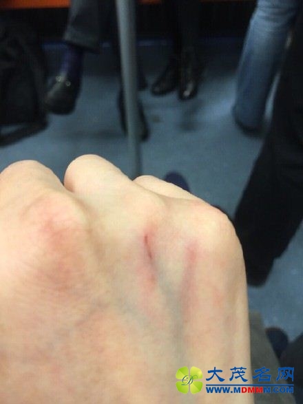 女乘客地铁遇色狼,报警遭殴打