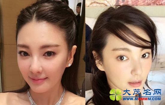 Before After