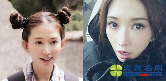 Before After